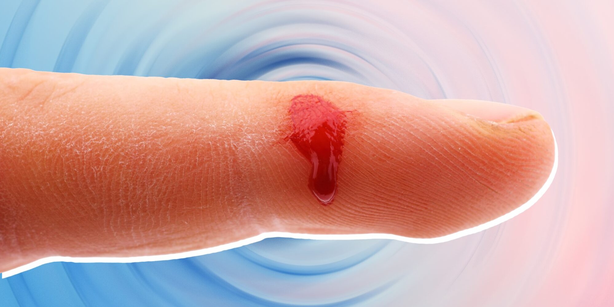 paronychia-infection-of-the-finger-stock-image-c009-0030-science